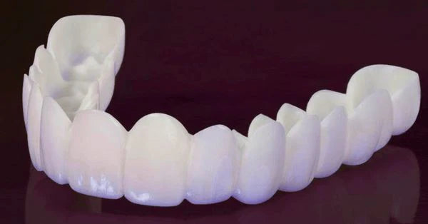 Carillas Dentales