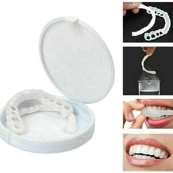 Carillas Dentales
