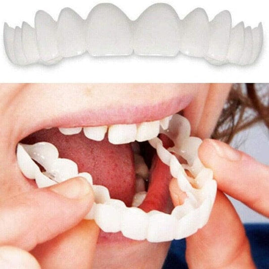 Carillas Dentales